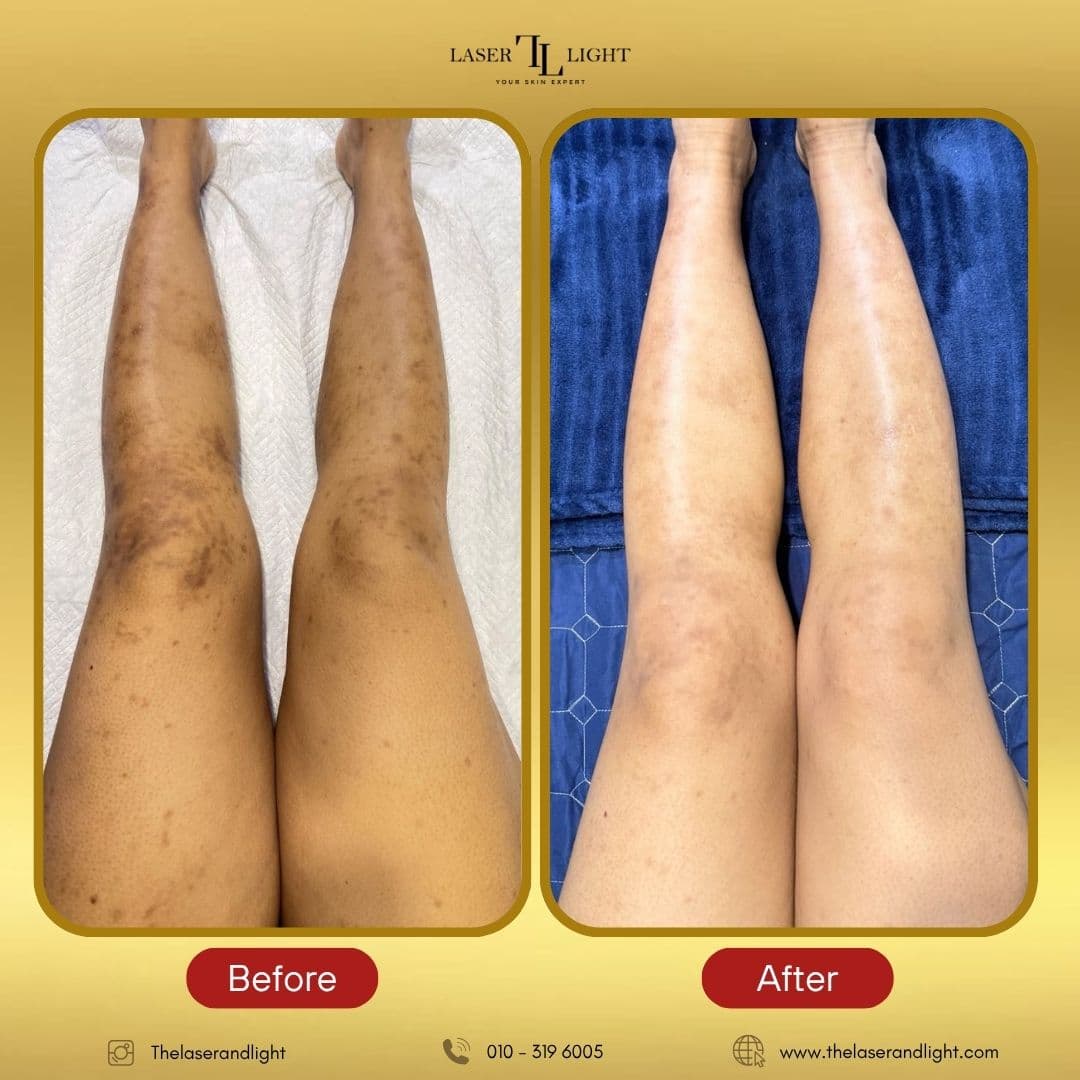Laser Light Skin Centre (Wangsa Maju)