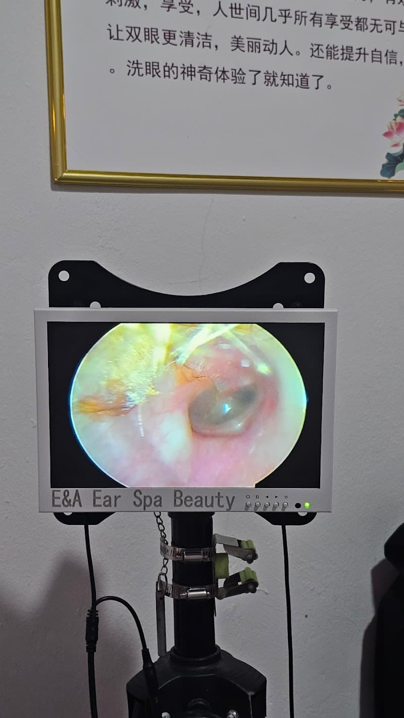 E&A Ear Spa Beauty 2