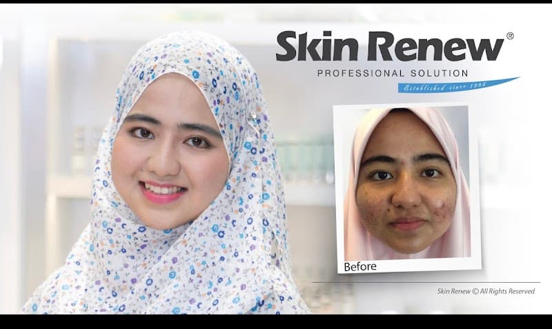 Skin Renew Aesthetics & Wellness @ The Curve Damansara | Facial Skin Care & Skin Laser Aesthetic 4