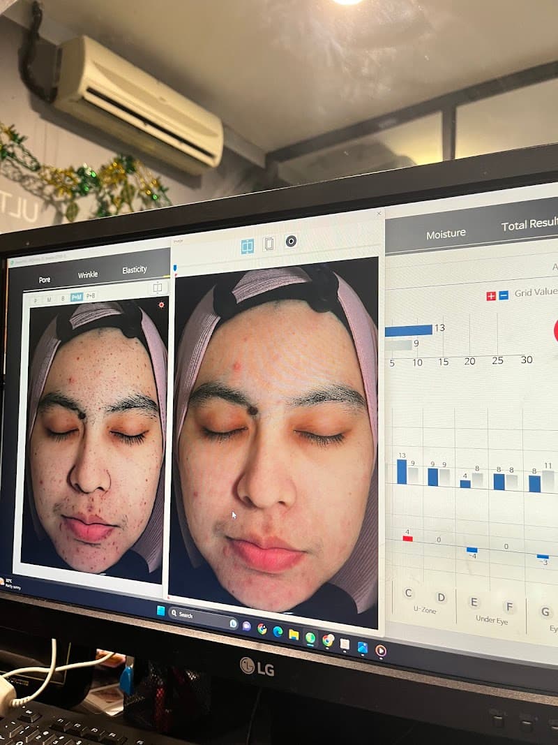 Hannan Medispa Muslimah Kepong 4